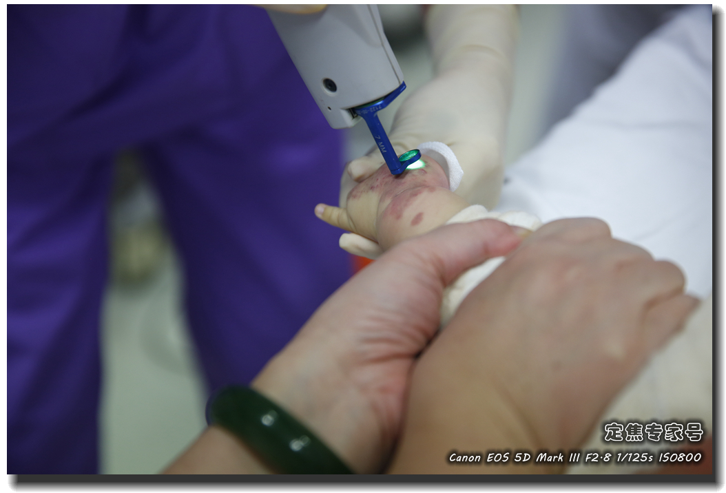 皮肤专家诊室故事连载之五,手心和眉心“开天眼”?