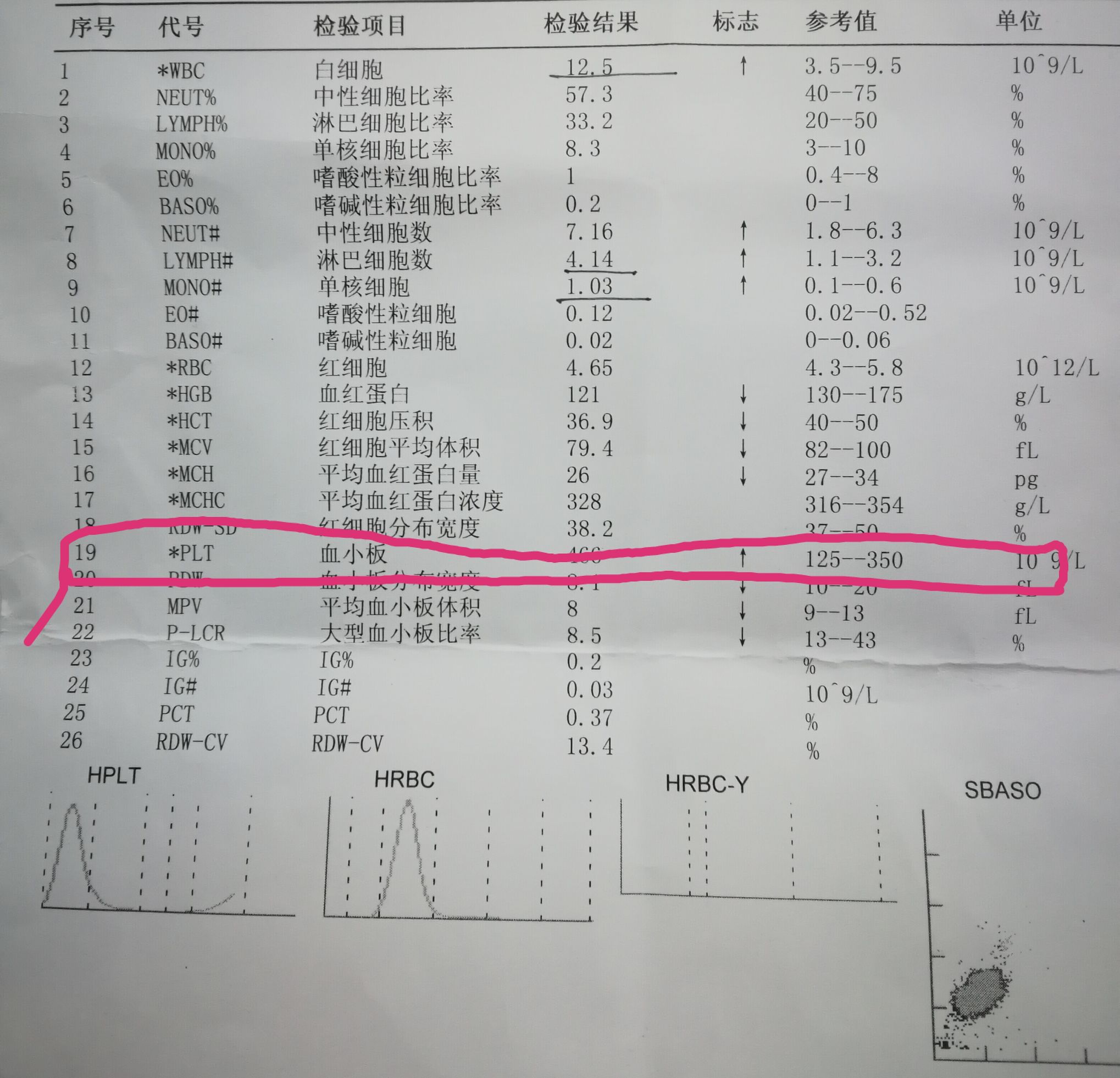 一分钟看懂化验单,化验单能看出肝功能不正常吗
