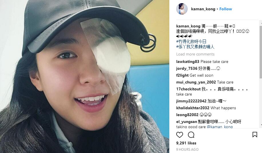 TVB美女小花生眼疮,变独眼龙但仍坚持开工,国产小鲜肉没得比!