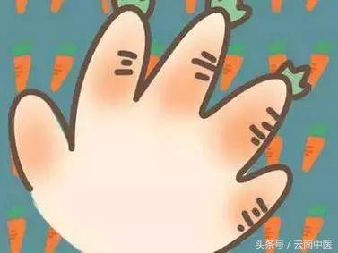 学会这几招让这个冬天更温暖,15个祛除冻疮小绝招