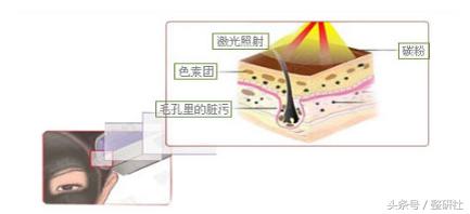 温良轻*女熟**修炼计——毛孔细致