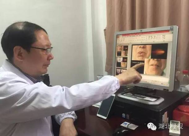 嘴唇长小肿块一查竟是癌！这个保护措施，不只女人需要！