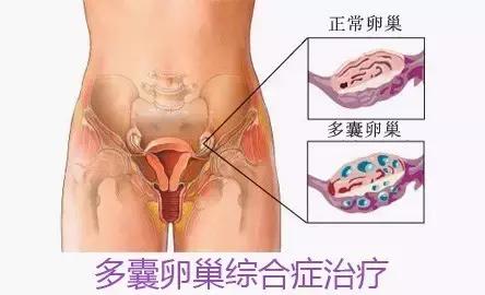 为什么有那么多女性不孕,为什么现在这么多女性不孕