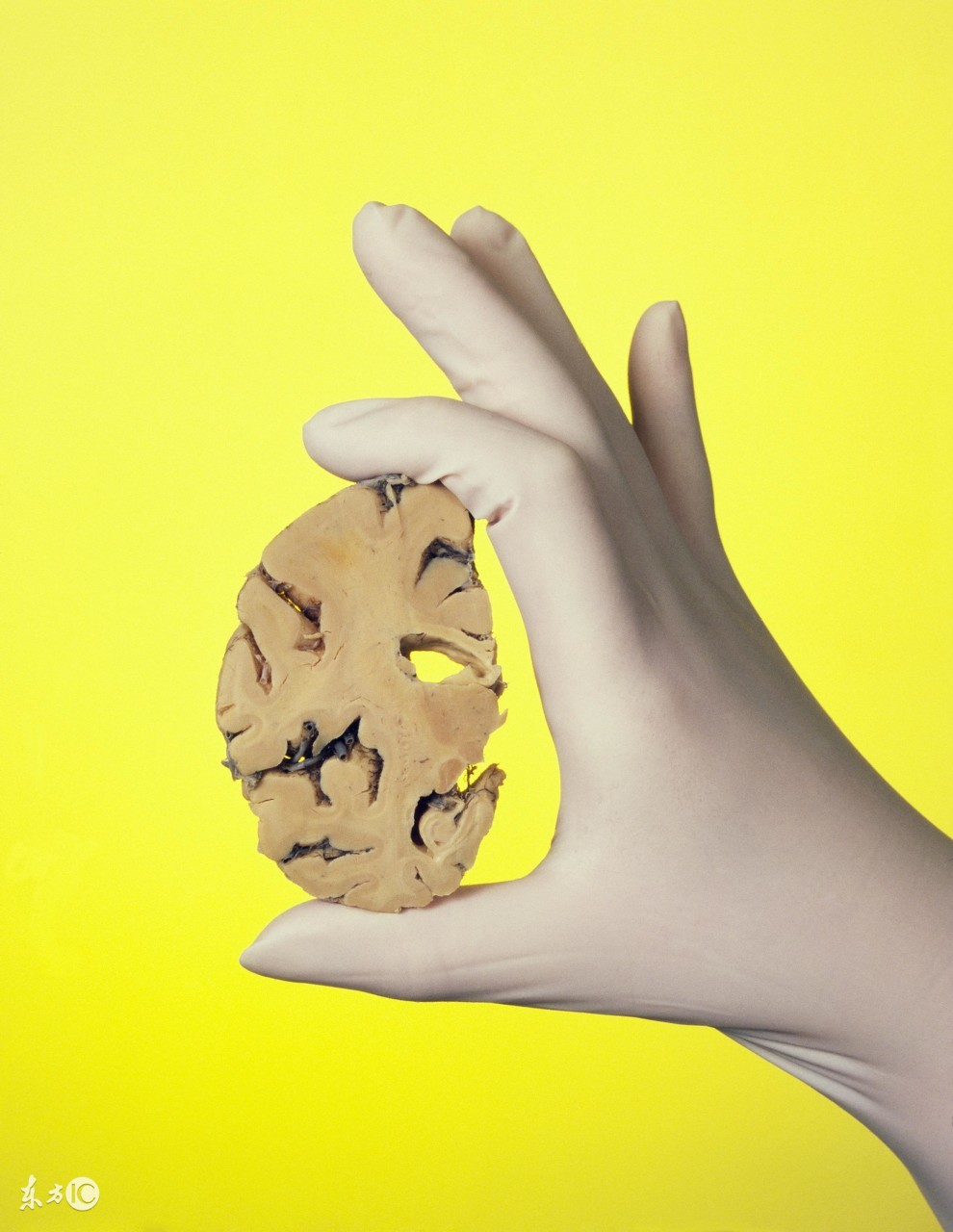 北京高新戒毒医院刘连清主任：*毒冰**后常见症状与危害？