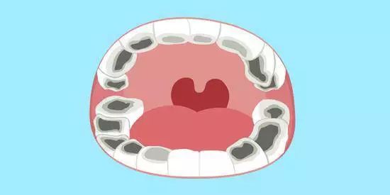 蛀牙是不是虫子钻的,蛀牙是真的因为有虫子吗