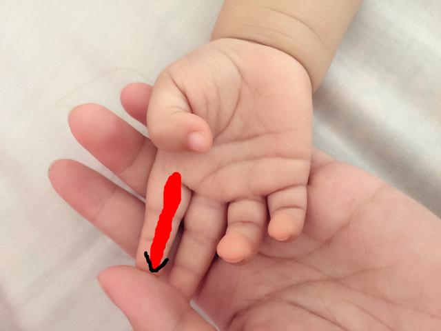 宝宝黄疸高怎么可以让黄疸退下来,宝宝黄疸偏高宝妈吃什么可以缓解