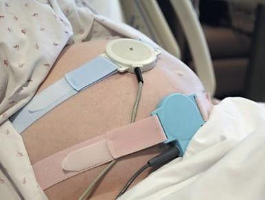 胎心监护异常的原因及处理方法,胎心监护有点不好需要注意什么