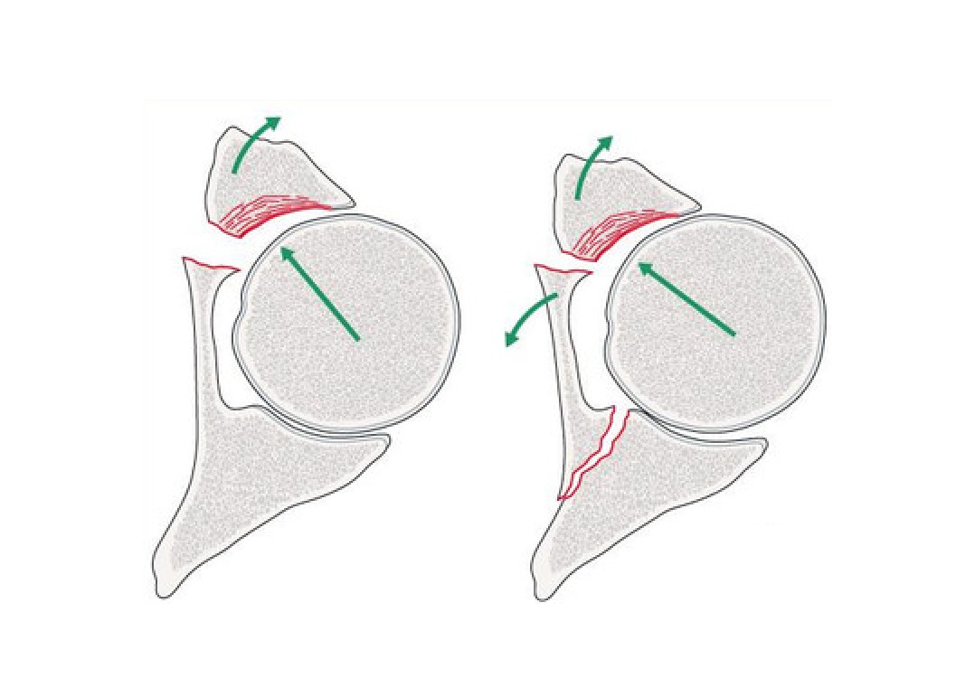 奥运会运动员扭伤用药,奥运会运动员康复训练