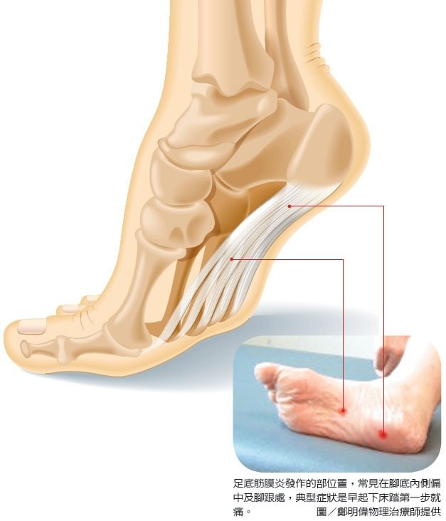 早晨跑步还是晚上跑步对身体好,早上跑步还是晚上跑步对身体好