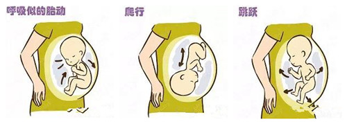 关于孕期胎动的那些事儿