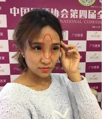 微整形黑幕深扒 (微整形有哪些黑幕)