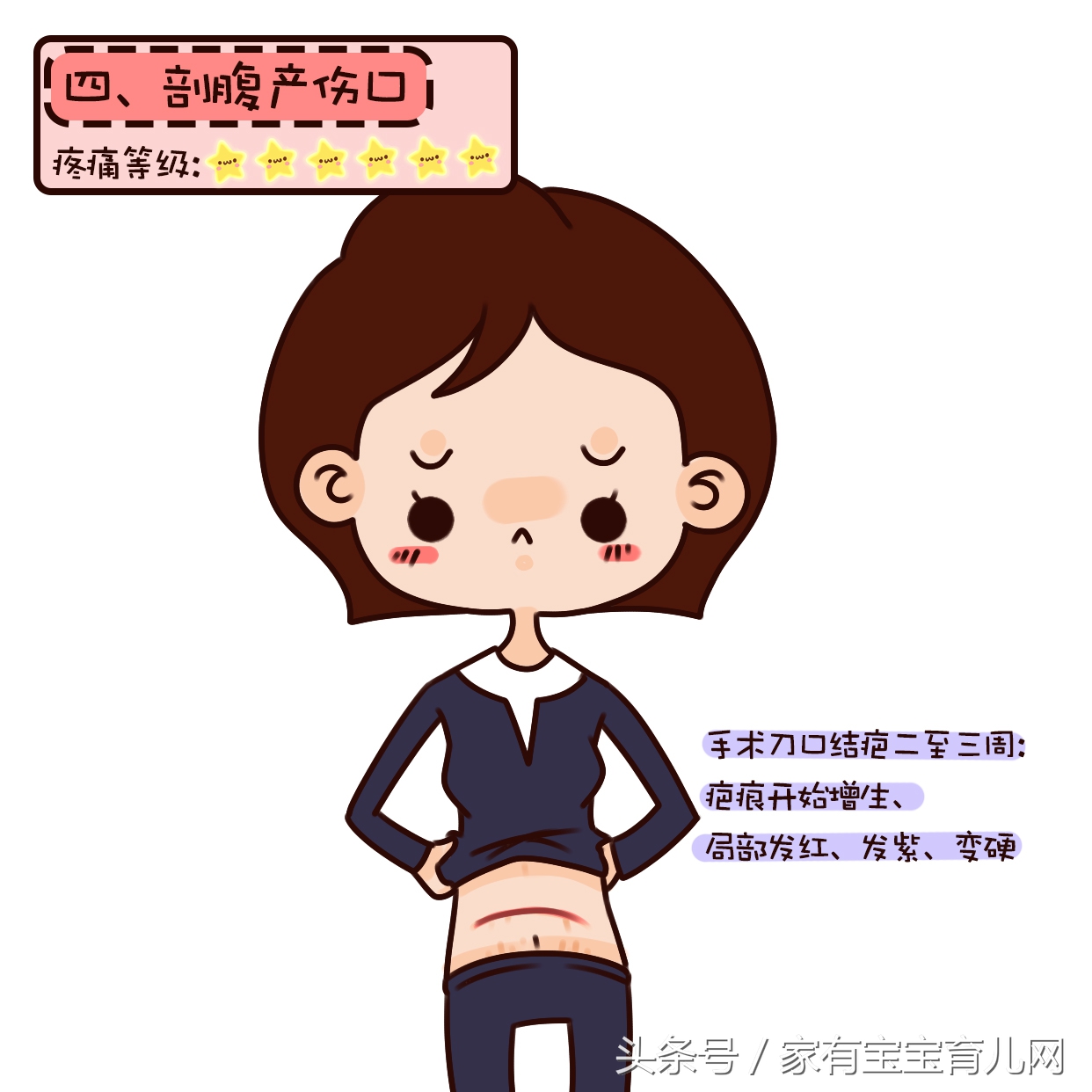 剖腹产最疼的阶段有哪些,剖腹产最疼的几件事