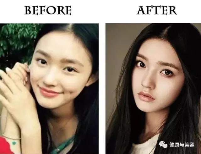 杨幂、唐嫣、神仙姐姐的鼻子原来是这样“整的”！