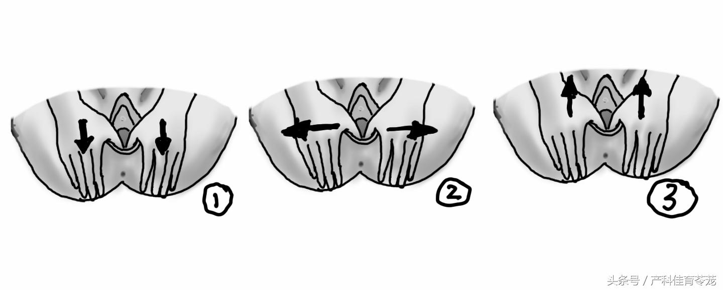 给您支几招，避免不必要的会阴侧切