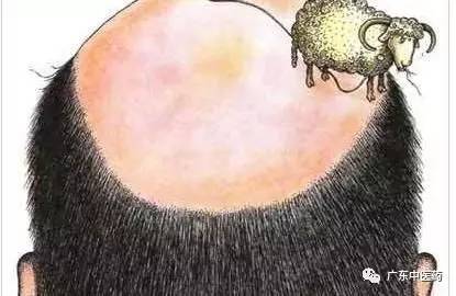 医生证明90后这一代人比他们的父辈脱发来得要早，怎么防治？