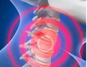 成都中医院疼痛科医生,成都中医药大学附属医院疼痛专家