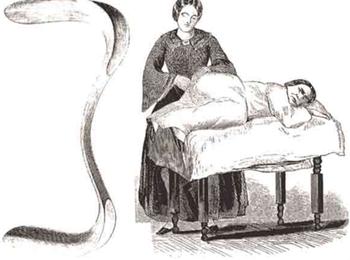 他完成首例妇科手术,被誉为女性的恩人,却因一场实验被批为恶魔