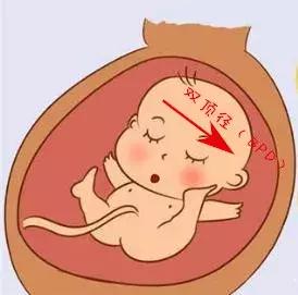 教你读懂产检b超单上英文缩写,如何看懂16周产检b超