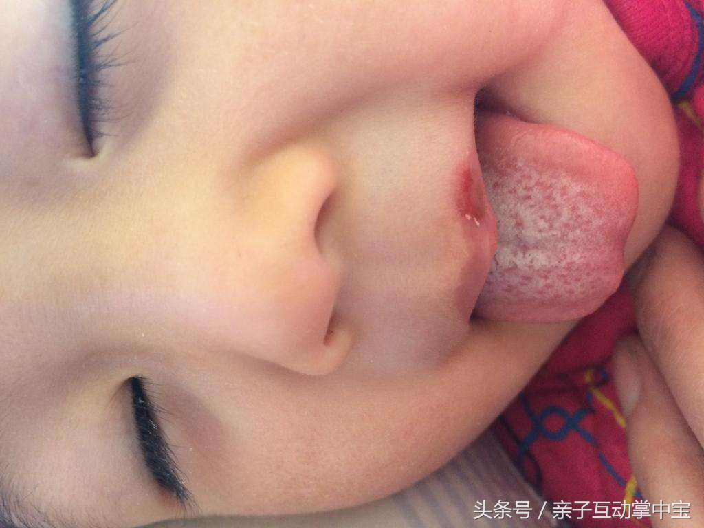 小朋友积食发烧要持续多久,儿童积食后反复发烧有人说中邪了