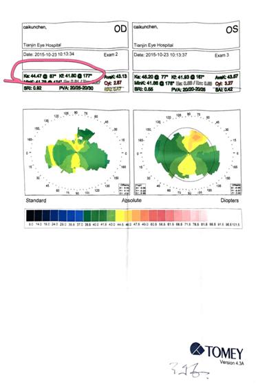 弱视专家王大夫,王大夫小儿微针疗法视频