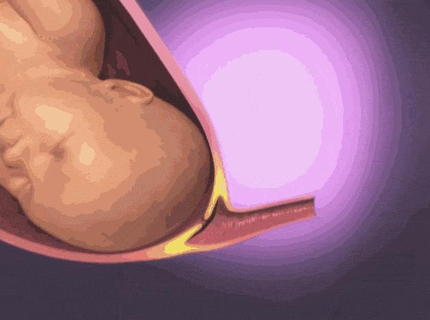 生孩子太慢对胎儿有什么影响,生孩子产程太长会导致宝宝缺氧吗