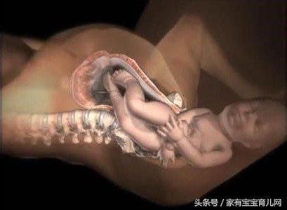 撕裂和侧切哪个好恢复,顺产侧切和撕裂哪个好恢复