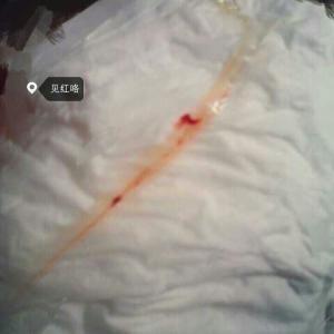 临产前见红是什么样子,临产前见红是什么情况