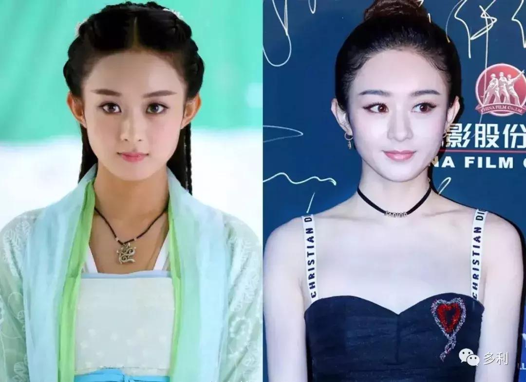 赵丽颖瘦脸的正确方法,赵丽颖是如何瘦脸瘦颧骨的