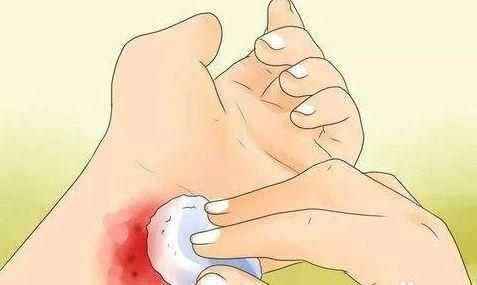 孩子擦破皮的脸需要怎么处理,小孩被刀片划伤伤口很深要缝针吗