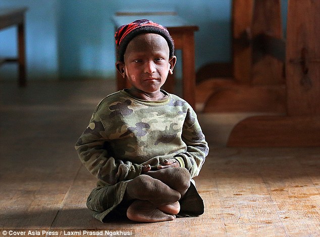 小男孩一出生无鼻无耳无眼,小男孩一出生奇丑无比