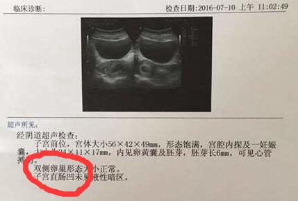 孕期B超单透露的重要信息!教你看懂9大关键指标