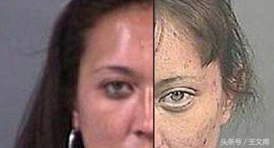 吸毒的人眼睛有什么特征,吸毒的人眼睛是什么样特征