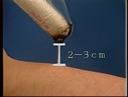 艾灸八髎穴的功效和好处,人体穴位艾灸大全