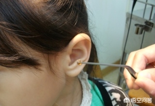 小孩子耳朵有异物怎么弄出来,孩子耳朵里进小东西该怎么办