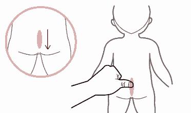 3岁宝宝积食5天不想吃饭怎么办,3岁多宝宝积食有效解决方法