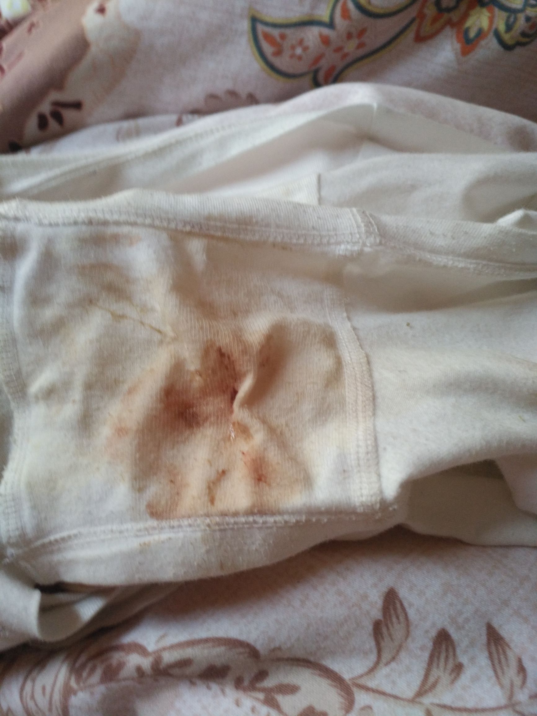 头胎顺产记录,顺产催产记录表