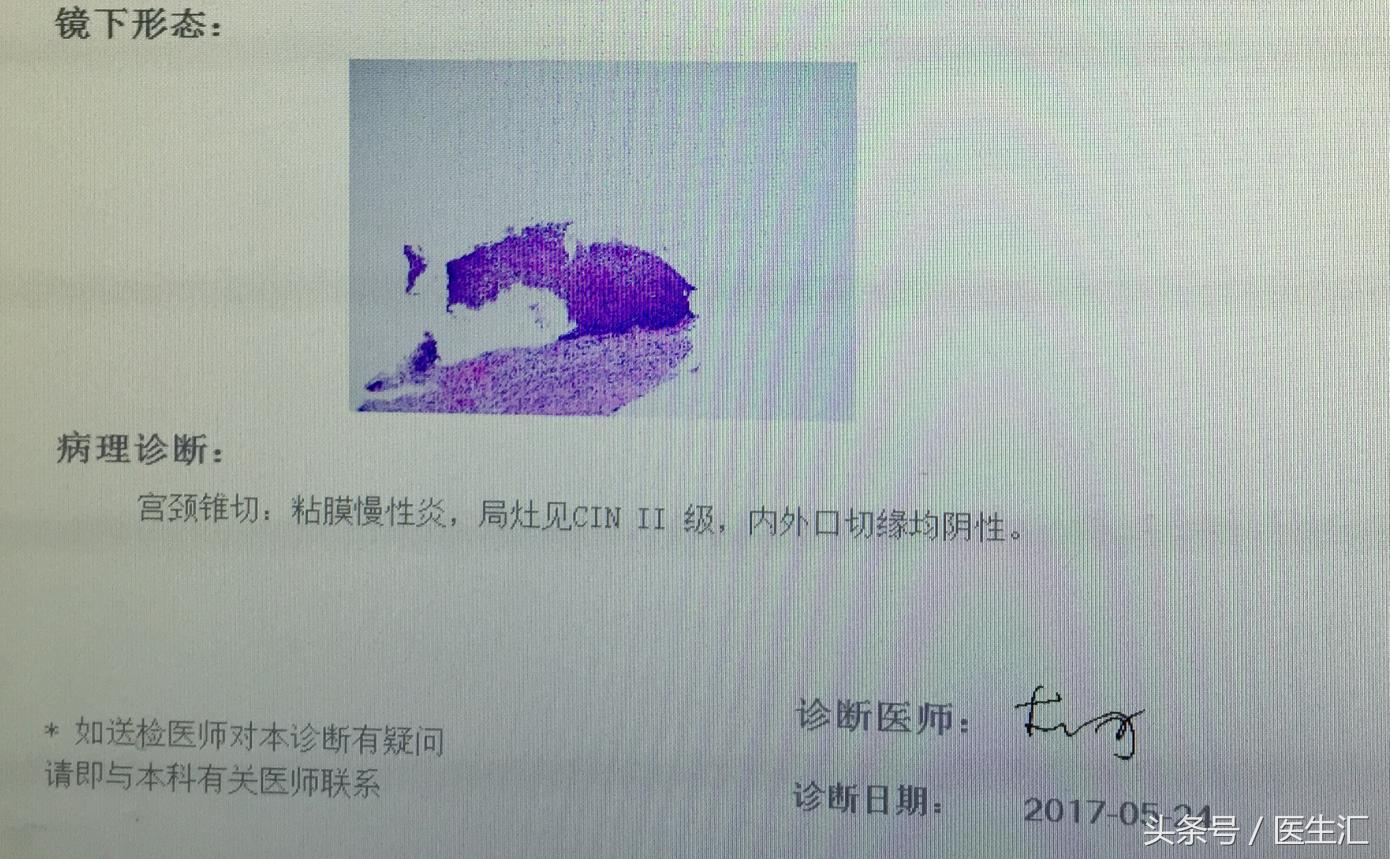 子宫腺肌症打闭经针出血还是很多,子宫腺肌症经期出血量大怎么治疗