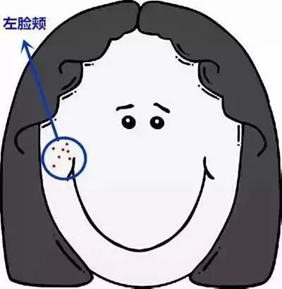 郑爽屏幕前貌美如花，幕后满脸痘花，明星都被坑的痘痘该怎么治？