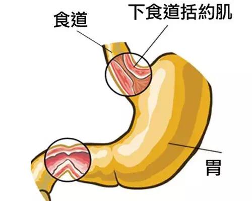 孕期严重烧心怎么办快速缓解一下,孕妈妈烧心是宝宝长头发了吗