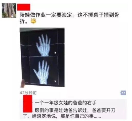 爸爸辅导作业竟致手骨骨折，学业之痛主要是这六点没做好