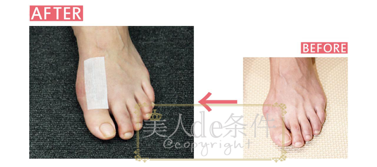 林允晒医美照还嫌贵？谁让她不了解隔壁岛国的医美全攻略