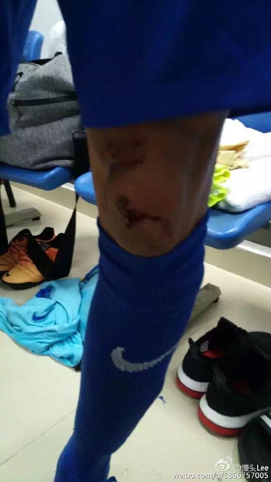 中国足球5.19惨案,史上最耻辱足球比赛