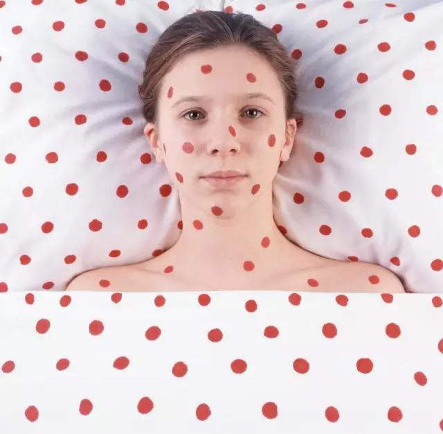 天气热手上长痘怎么办,为什么天气一热就爆痘