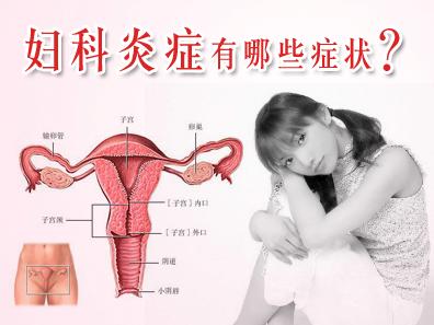 十女九带从生活习惯和饮食预防妇科炎症感染