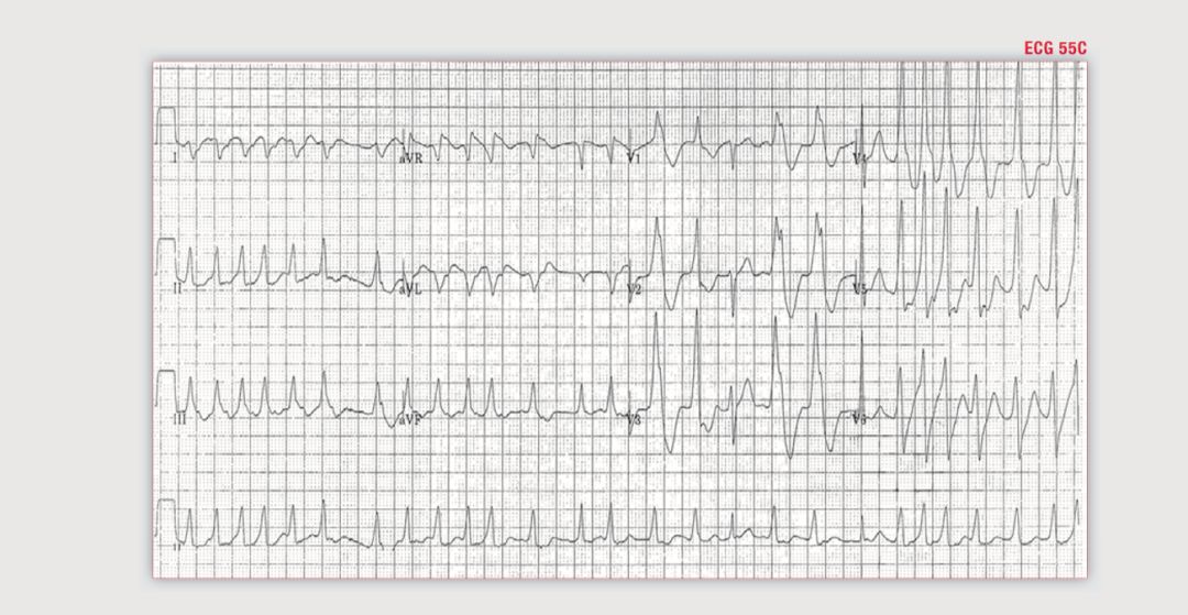 读心有术265,读心有术205期视频
