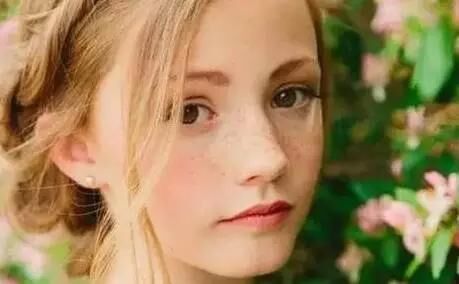 修护敏感肌红血丝,怎样修复敏感泛红肌肤