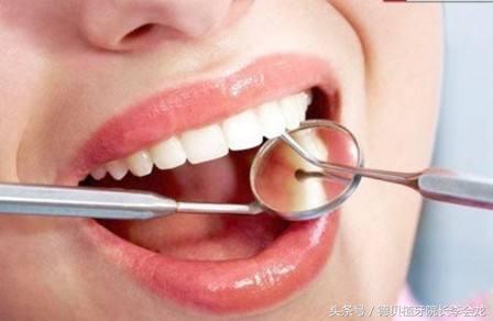 烤瓷牙表面掉瓷了对人身体有害吗,小加工厂做的烤瓷牙对身体有害吗