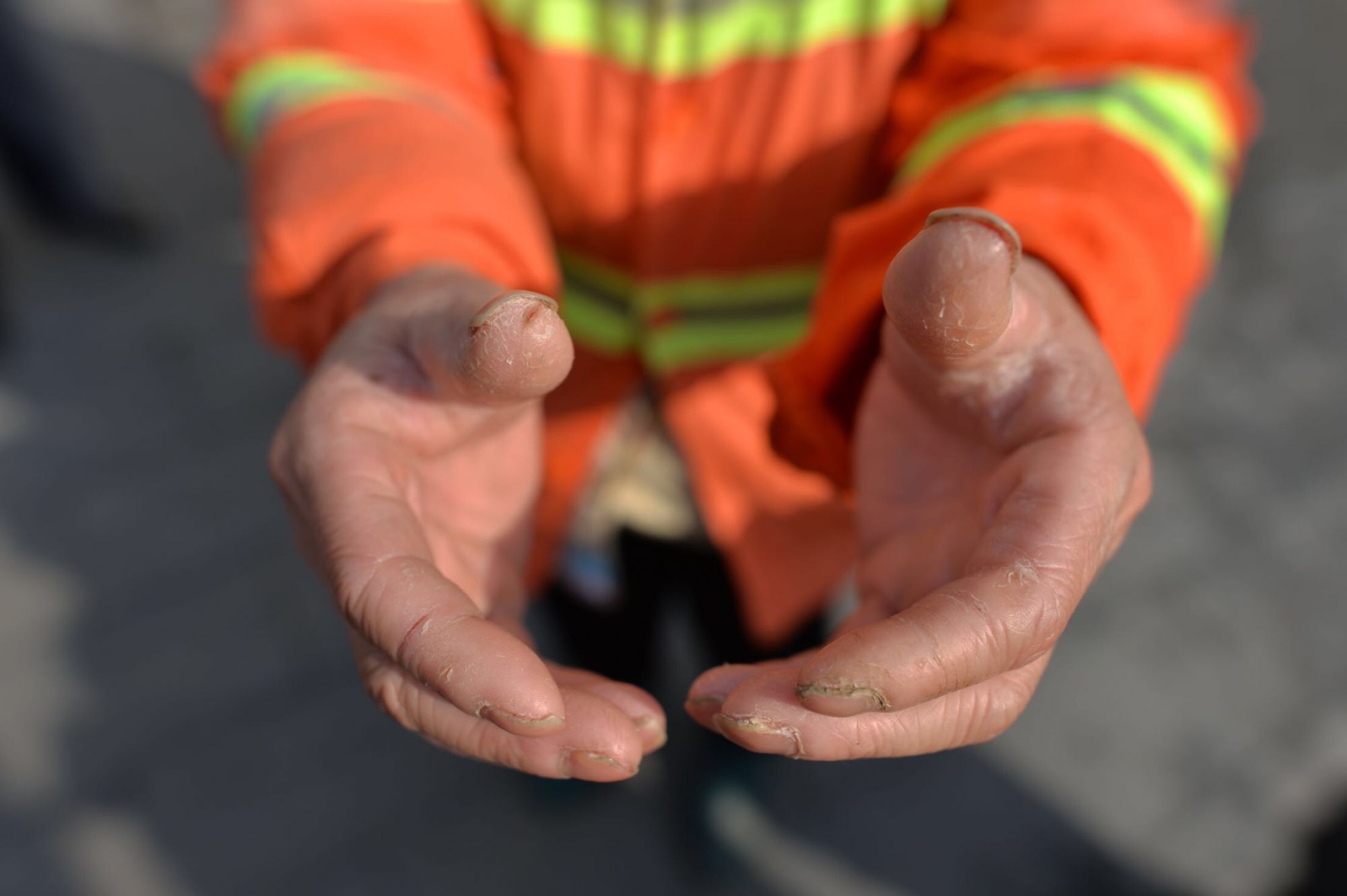 每双皲裂出血的糙手记得他们铲过的雪