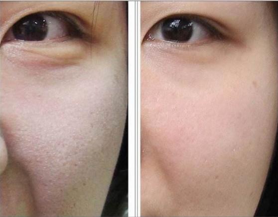 强烈种草：法澜妃白藜芦醇黄金面膜太棒了！简直完爆前男友面膜！