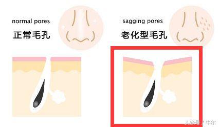 改善皮肤干燥毛孔粗大的方法,如何改善肌肤暗沉毛孔粗大的方法
